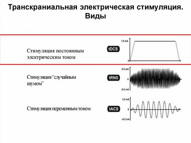 Ar įmanoma pagerinti atmintį elektra?