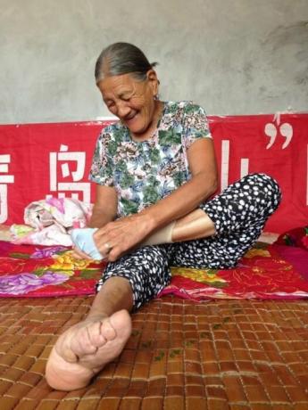 Kinijos grožio aukos, kurie stebėtinai mažų pėdų. Populiariausios nuotraukos / Foto: interesnoznat.com. 